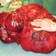 Illustration for article titled How to grow a 100-pound tumor